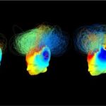 Redes cerebrales en dos pacientes en estado vegetativo (izquierda y centro) conductualmente iguales. Sin embargo, la actividad neuronal del paciente del centro cuando se le ordenó que se imaginara jugando al tenis es similar a la de la persona de la derecha (un adulto sano)