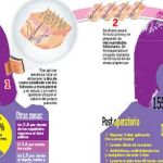 Injertos: la gran esperanza del hombre calvo