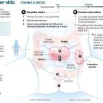 Extrofia Vesical: nacer con la vejiga fuera del cuerpo