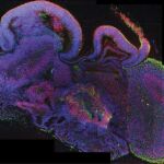 Sección de un órgano cerebral con diferentes regiones cerebrales.