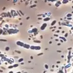 El CSIC lidera un estudio que abre nuevas vías para tratar el lupus