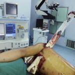 Zhumadian en el quirófano del hospital