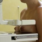 Dos tercios de los ensayos contra el cáncer de mama inflaron sus resultados