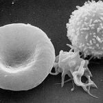 Los glóbulos blancos pueden provocar daños cardiovasculares al proteger al cuerpo