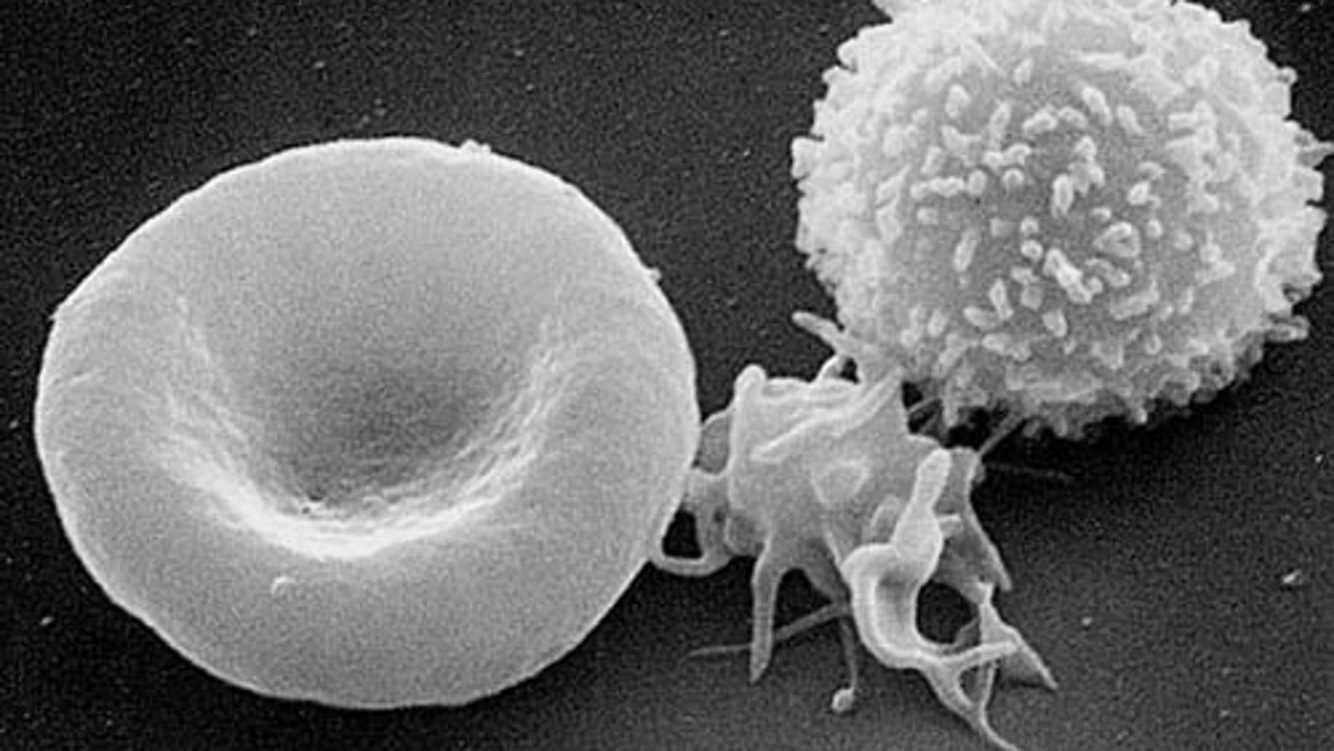 Los glóbulos blancos pueden provocar daños cardiovasculares al proteger al cuerpo