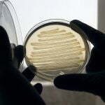Bacteria E.coli