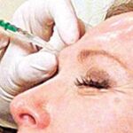 Nuevo tipo de botox para las arrugas