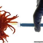 Modifican el virus del herpes labial para combatir el cáncer de piel