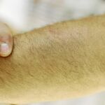 Jesús tiene un hematoma en el brazo izquierdo a consecuencia del golpe que recibió con la porra del agente municipal. También tiene una herida en el pecho causada por la punta del bolígrafo que le clavaron