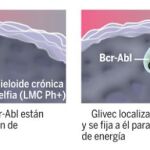 El fármaco que revolucionó la leucemia mieloide tiene sustituto