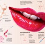 Queiloplastia: el peligro de unos labios artificiales