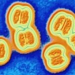 Bacteria de la meningitis