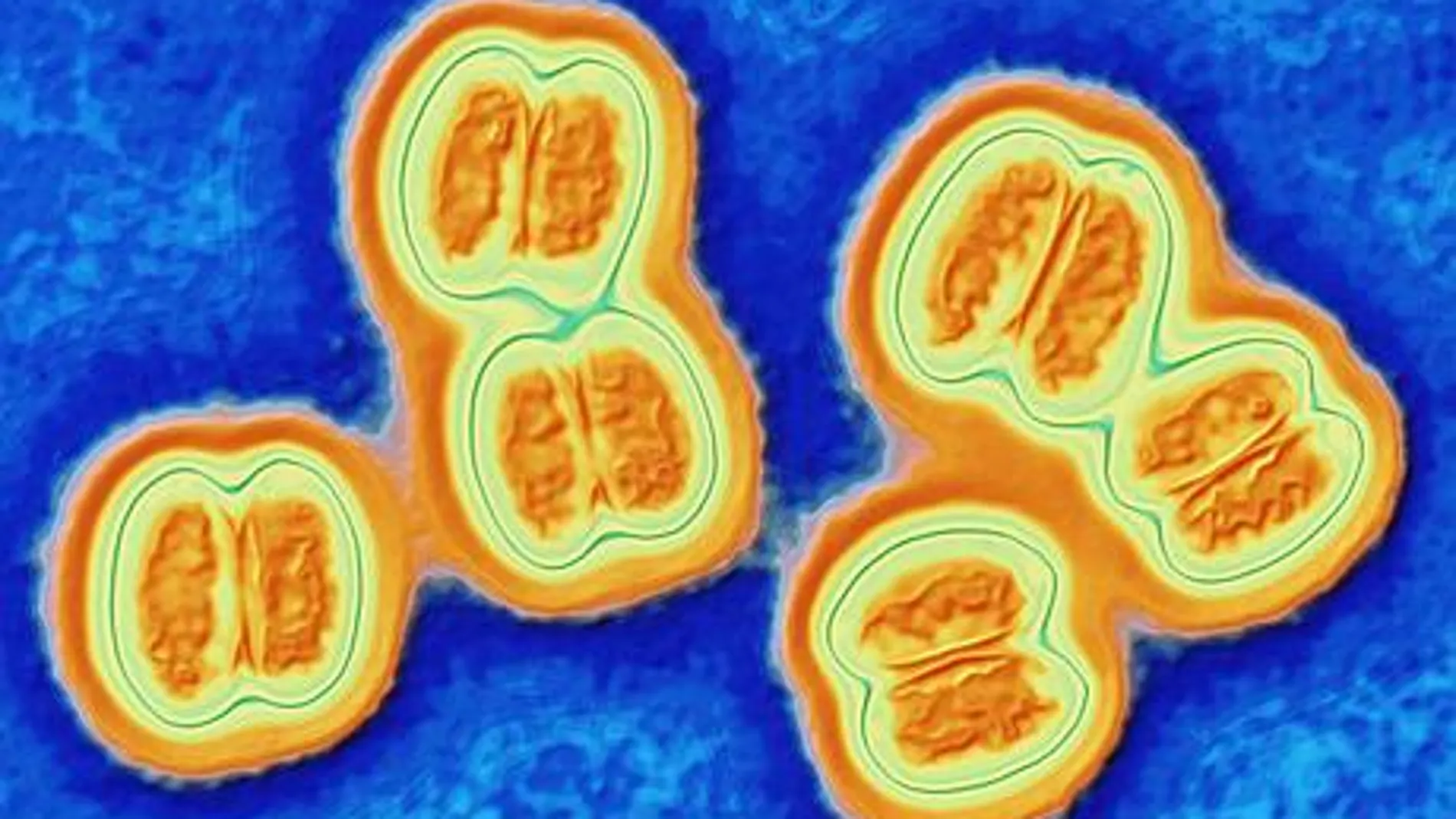 Bacteria de la meningitis