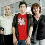 Células madre para reconstruir una cara