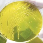 bacteria