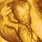 El PSOE critica a la Xunta por ofrecer ayudas contra el aborto