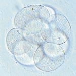 Células madre sin riesgo de cáncer