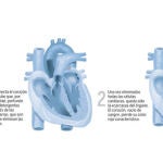 Cuenta atrás para los corazones «a la carta». Vea el GRÁFICO COMPLETO en documentos adjuntos