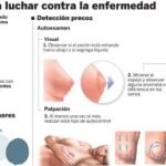 Prevención: un tumor detectado a tiempo puede ser eliminado sin dejar rastro