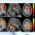 La investigación de la Universidad Charité sugiere que existe un vínculo entre el grosor de la región genital del cerebro y la frecuencia de las relaciones sexuales | Fotografía de archivo