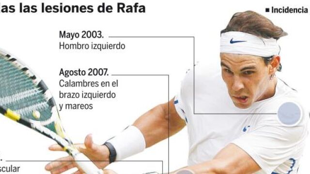 Nadal está sano