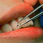 El hombre con más suerte del mundo gracias a su dentadura