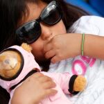 Los oftalmólogos alertan de la escasa protección de los ojos de los niños