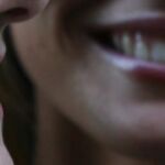 Una dentista se venga de su ex novio sacándole todos los dientes