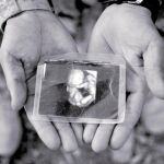 Ecografía que muestra un feto de pocas semanas de vida