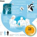 Pulgares con tres falanges