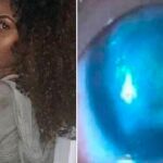 Miyako Aiko-Murray compartió su extraña enfermedad en las redes / Facebook