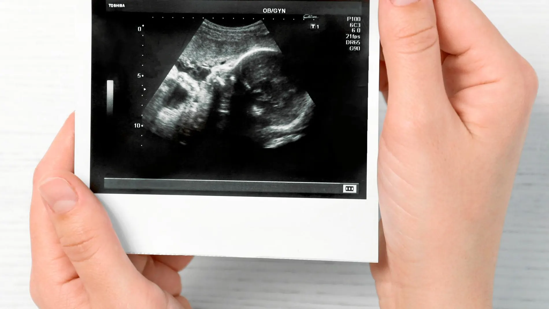 Determinar si la gestante es vulnerable será una de las claves en la investigación