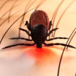 El virus de la fiebre hemorrágica Crimea-Congo se puede transmitir a través de la picadura de una garrapata