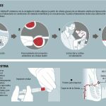 Primer fármaco de células vivas para la enfermedad de Crohn
