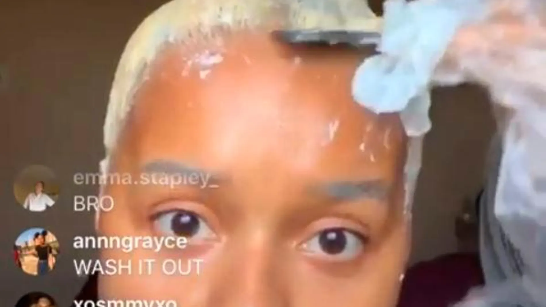 Durante la emisión en directo Loraine se quedó calva