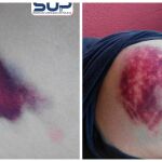 Heridas provocadas a los agentes
