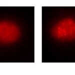 A la izquierda, célula de la sangre de un paciente con anemia de Fanconi antes de la corrección mediante el uso del sistema Crispr/Cas9. A la derecha, la célula ya corregida. Se observa cómo se repara la función de la ruta de la anemia de Fanconi | CSIC