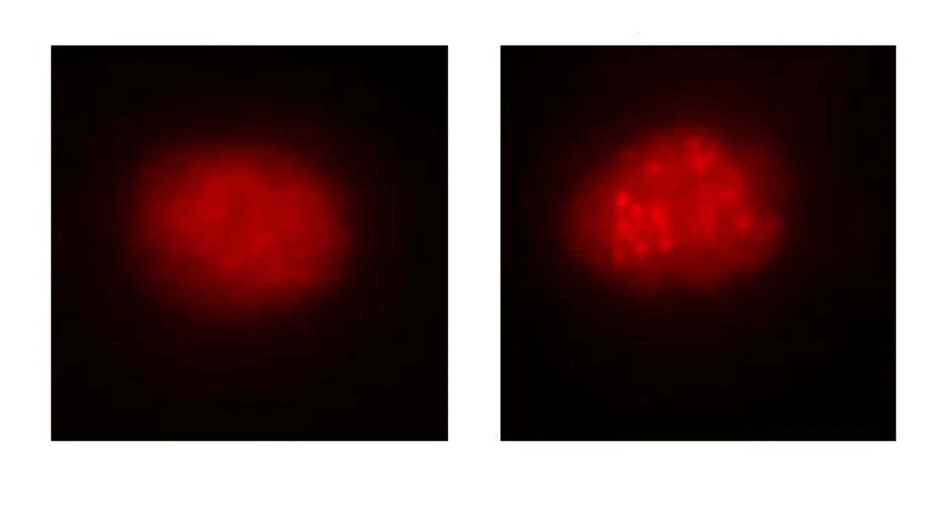 A la izquierda, célula de la sangre de un paciente con anemia de Fanconi antes de la corrección mediante el uso del sistema Crispr/Cas9. A la derecha, la célula ya corregida. Se observa cómo se repara la función de la ruta de la anemia de Fanconi | CSIC
