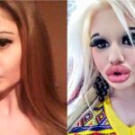 El antes y el después de Andrea Emilova tras someterse a 15 operaciones / Instagram
