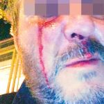 Agresiones en piscinas públicas de Madrid: "Eran siete, me amenazaron, te vamos a matar"