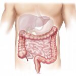 La dieta, el tema que más falsas creencias genera en los pacientes con Síndrome del Intestino Irritable