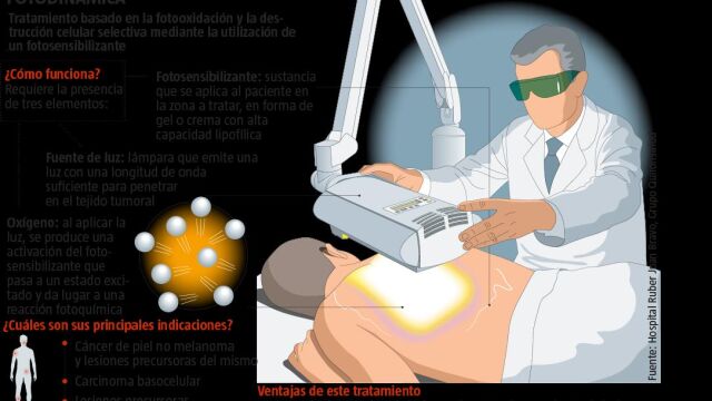 fotosensibilizantecicatriztratamientolesiones