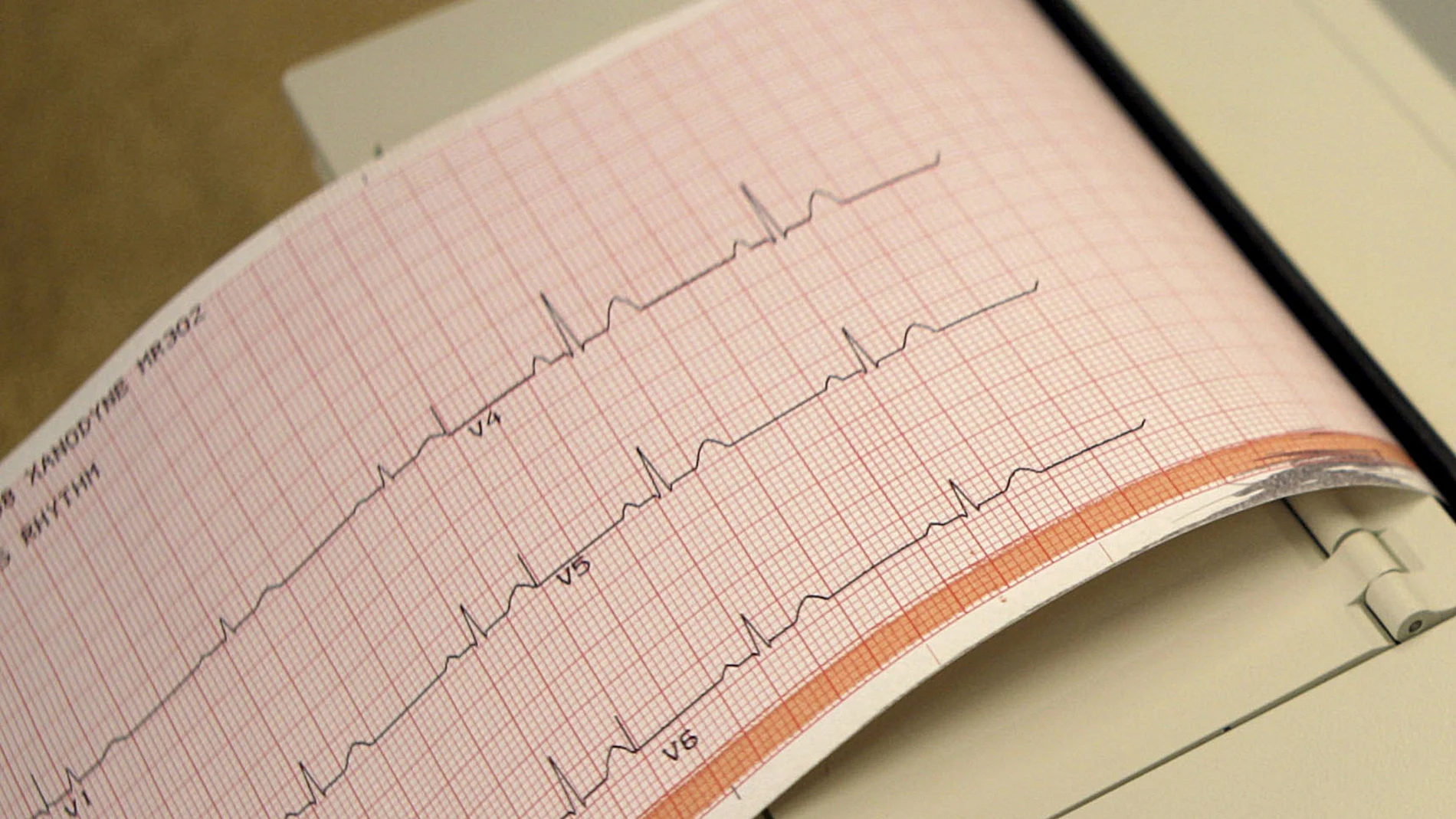 Las enfermedades cardíacas son la principal causa de muerte y enfermedad en el mundo