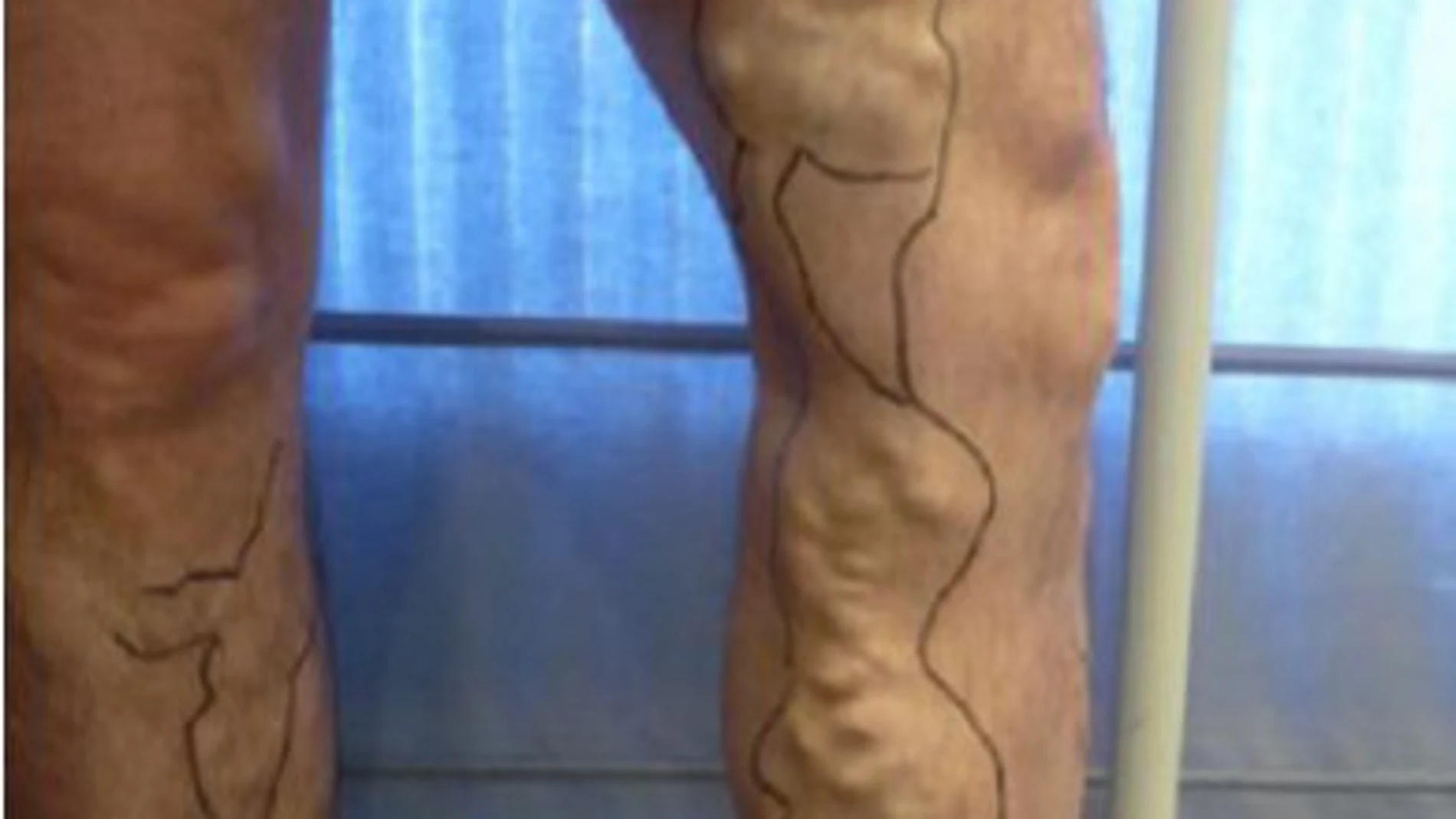 Foto de antes de la intervención