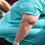 Imagen de archivo, una persona con obesidad