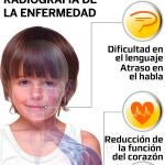 Síndrome de Duchenne