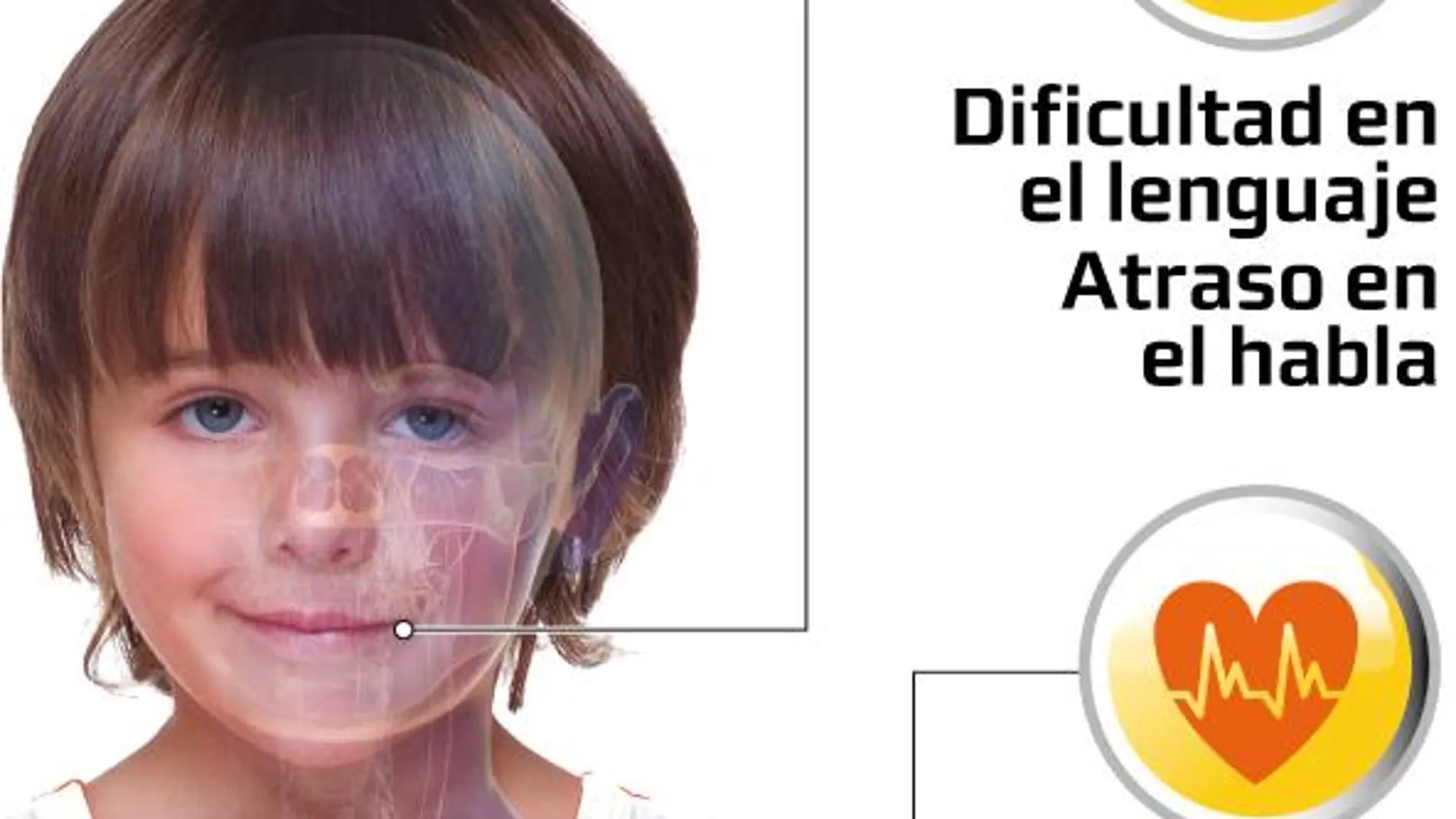 Duchenne radiografía
