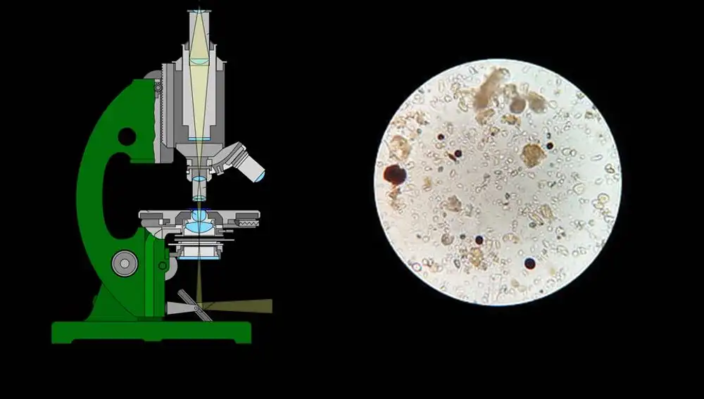 Esquema de microscopio óptico con muestra de su resolución.