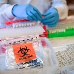 Test de diagnóstico para el Covid-19