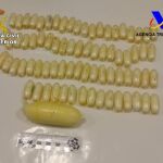 Bellotas de cocaína extraídas del cuerpo de la detenida